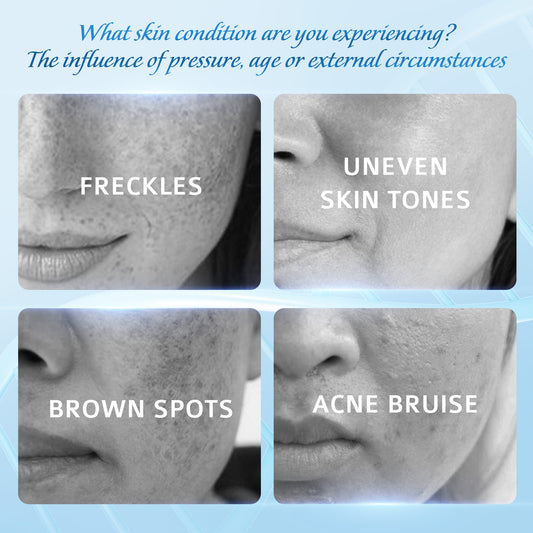 KemFresh Lady – Dưỡng trắng, mờ nám, giảm thâm – Cho làn da sáng khỏe, đều màu!