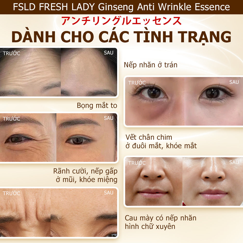 Tinh Chất Nhân Sâm Nhật Bản Fresh Lady Hỗ Trợ Giảm Nếp Nhăn, Ngừa Lão Hóa, Dưỡng Sáng Da